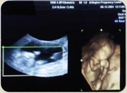 �� �������� ���� � ���������� ���� ��� �������� ������ ���������� �����������?